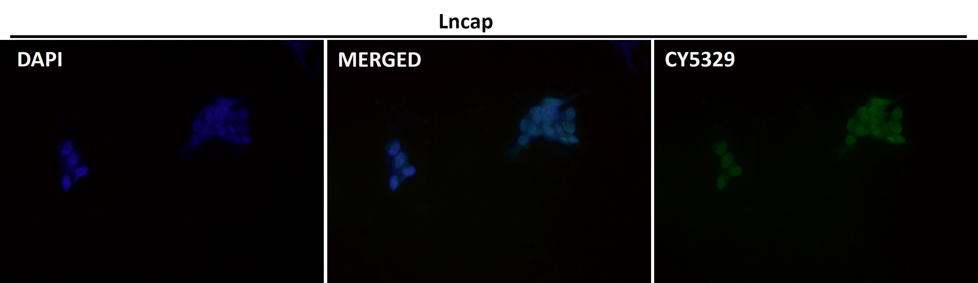 Androgen receptor Ab