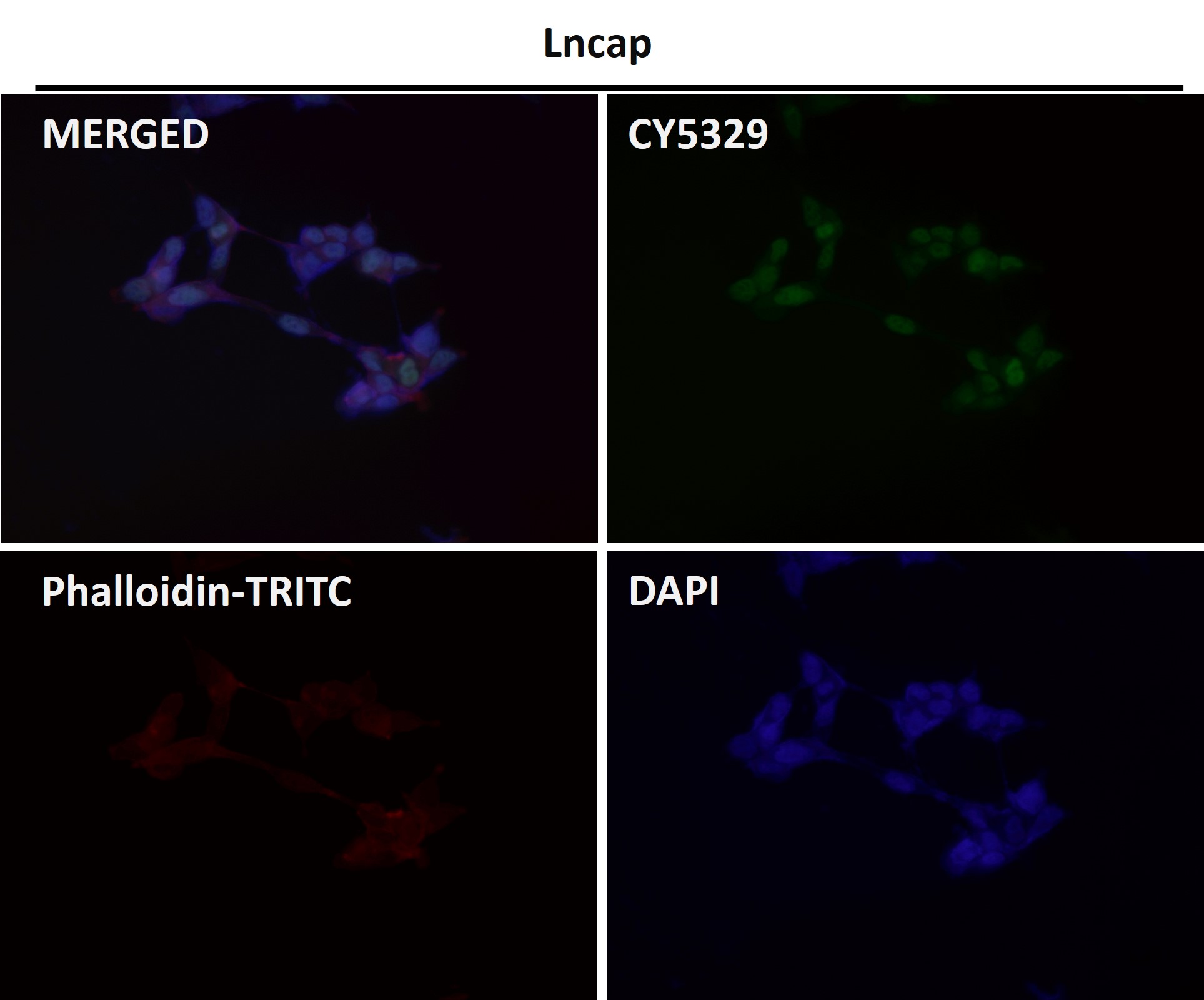 Androgen receptor Ab