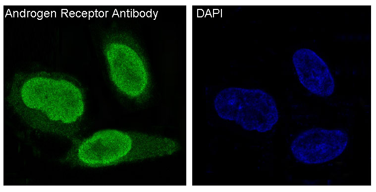 Androgen receptor Ab