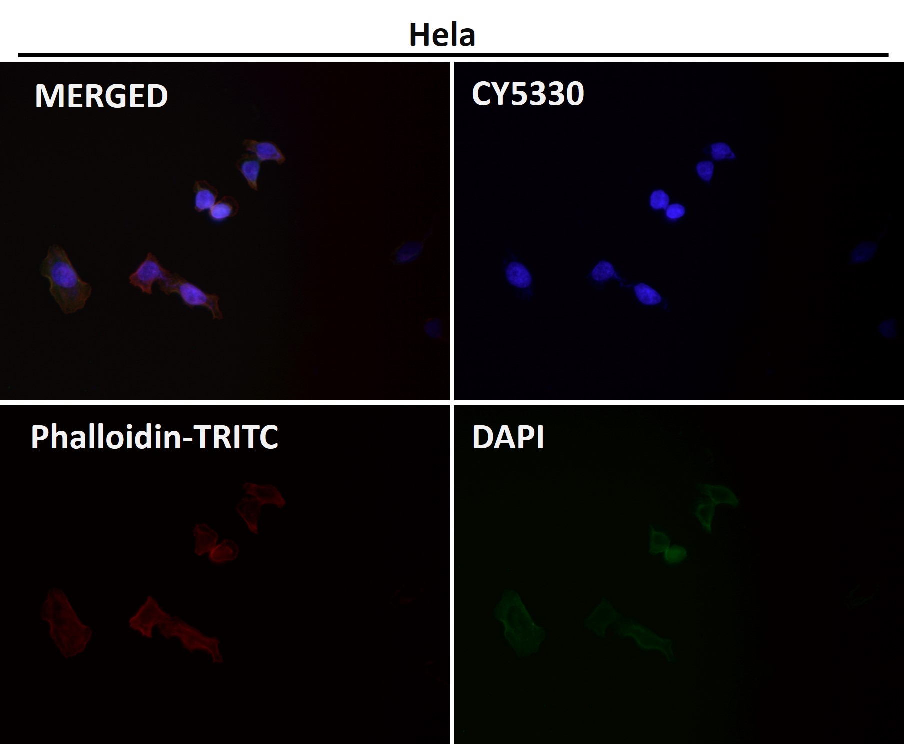 MMP1 Ab