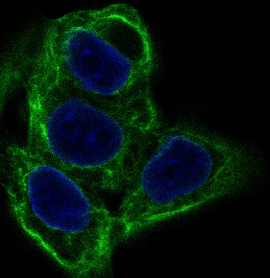 Cytokeratin 20 Ab