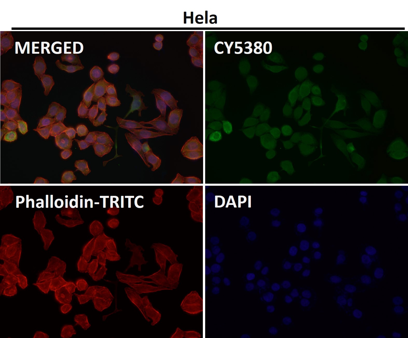 CXCR4 Ab