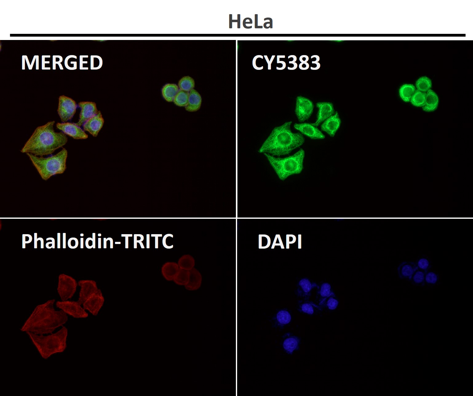 Cytokeratin 8 Ab