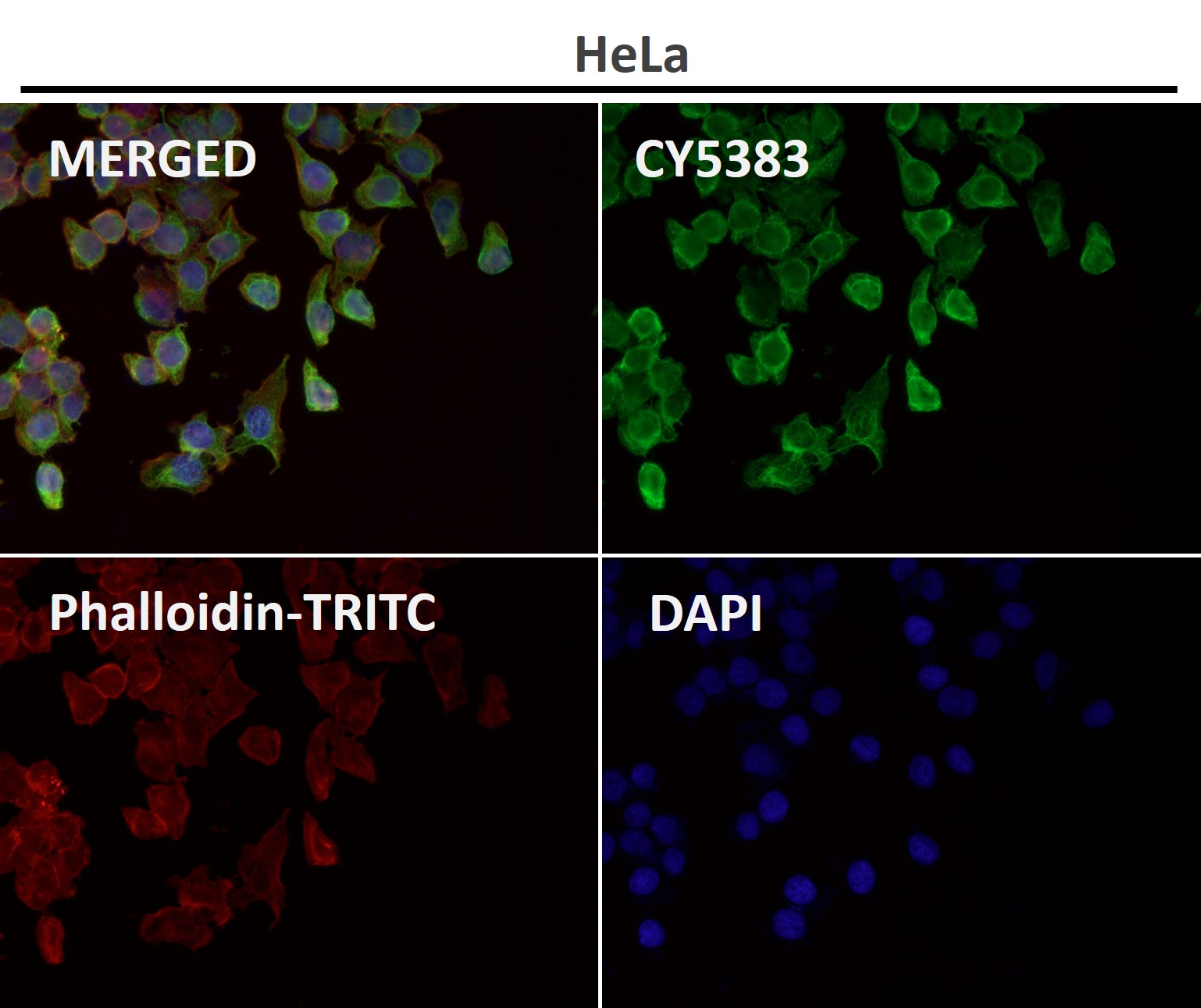 Cytokeratin 8 Ab