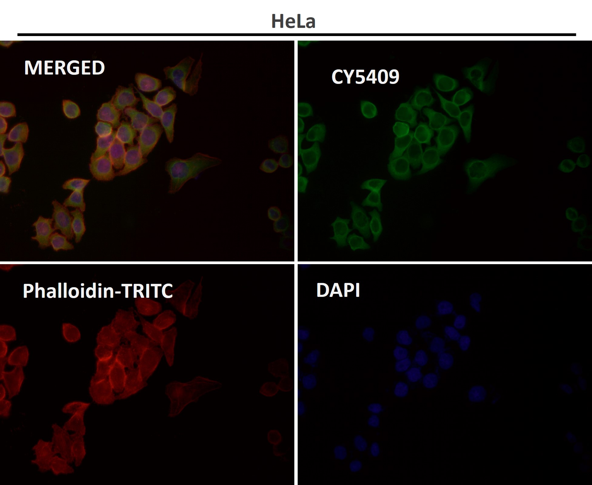 CDK5 Ab