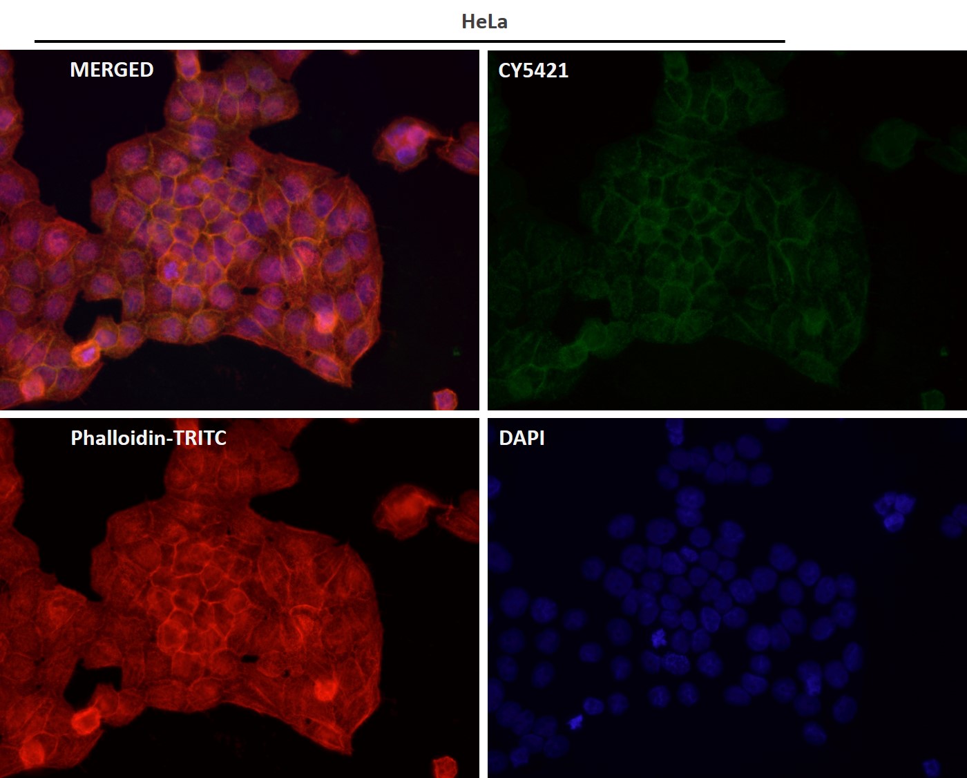 Alkaline phosphatase Ab