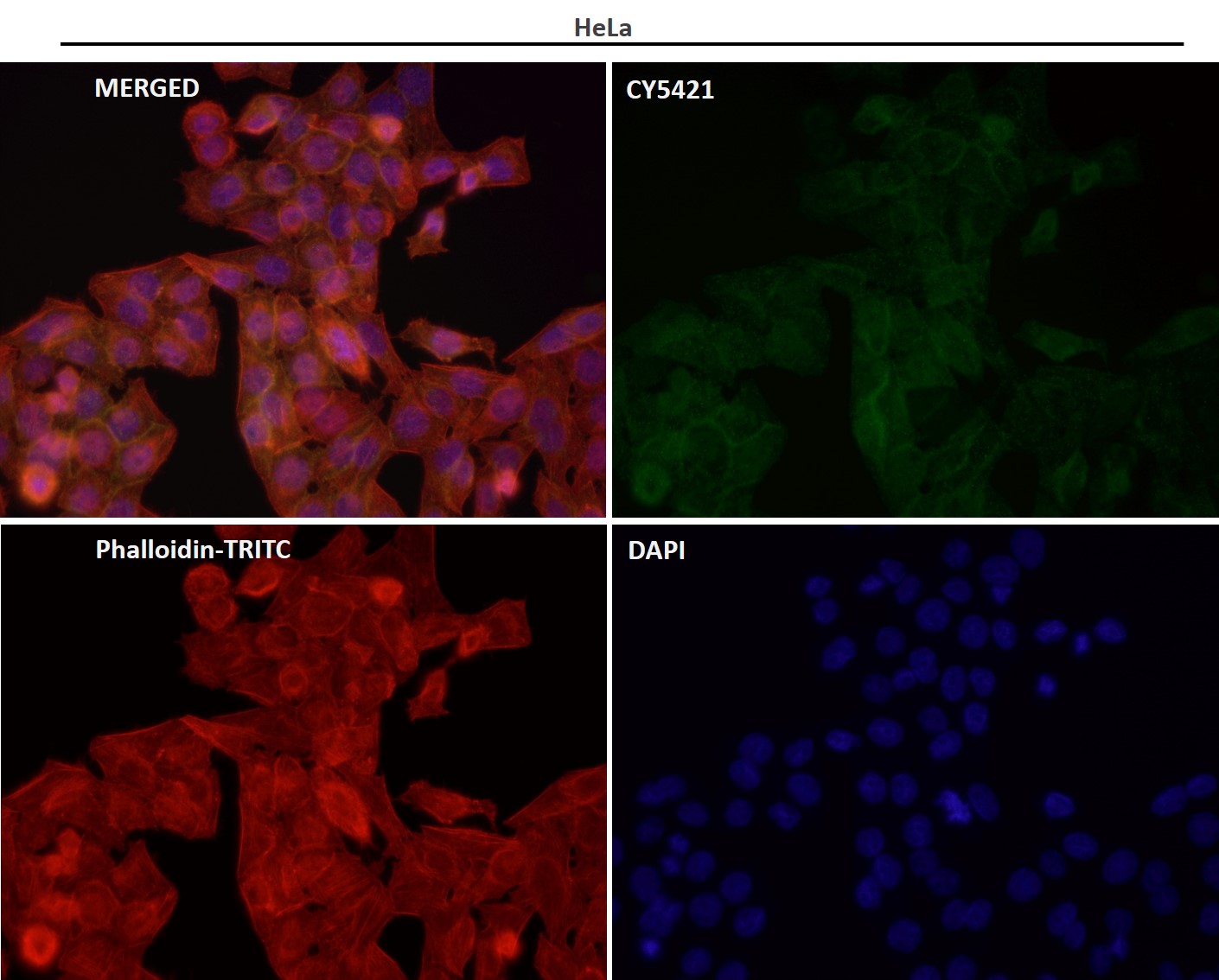 Alkaline phosphatase Ab