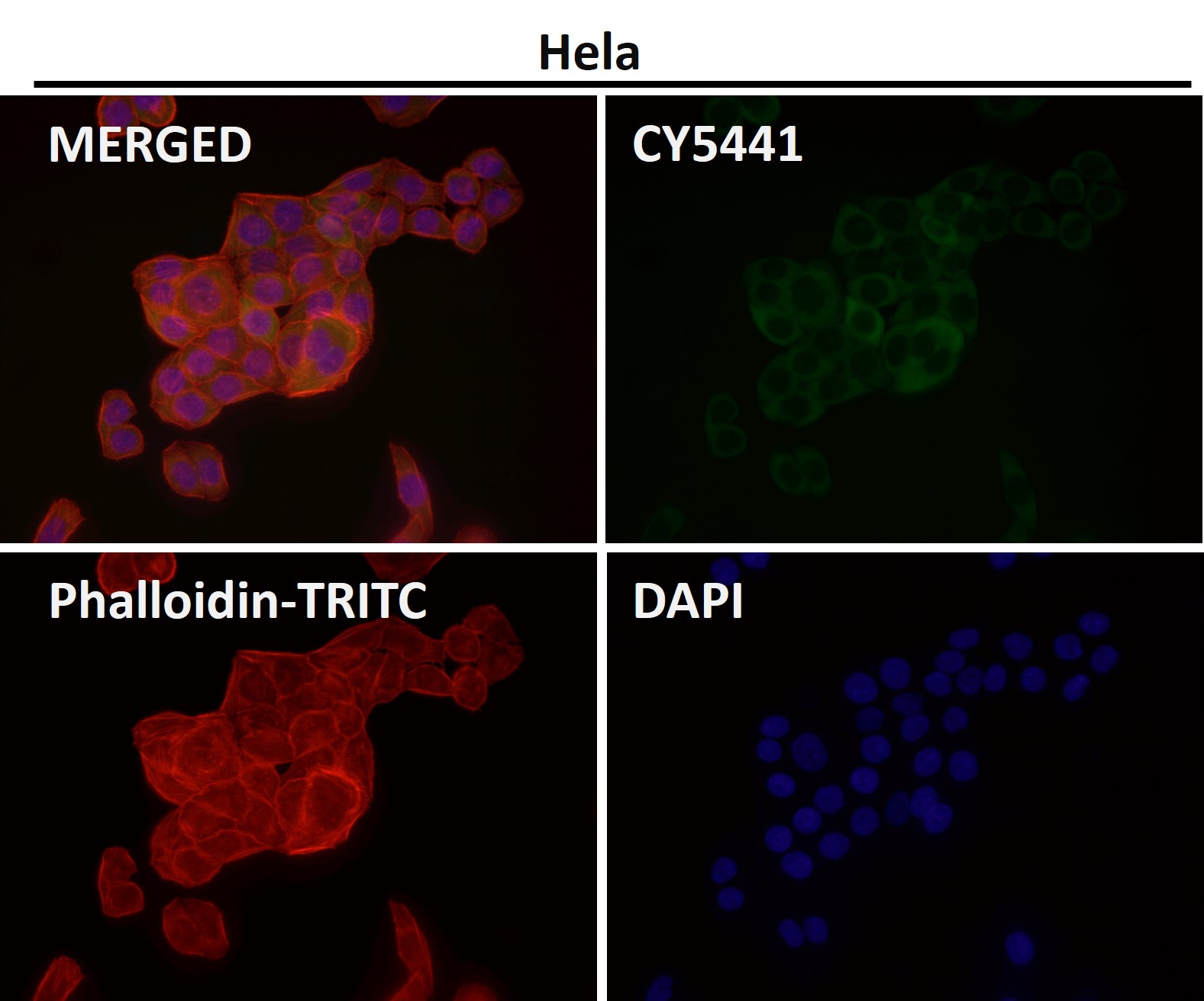 Calcium binding protein 1 Ab