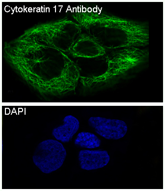 Cytokeratin 17 Ab