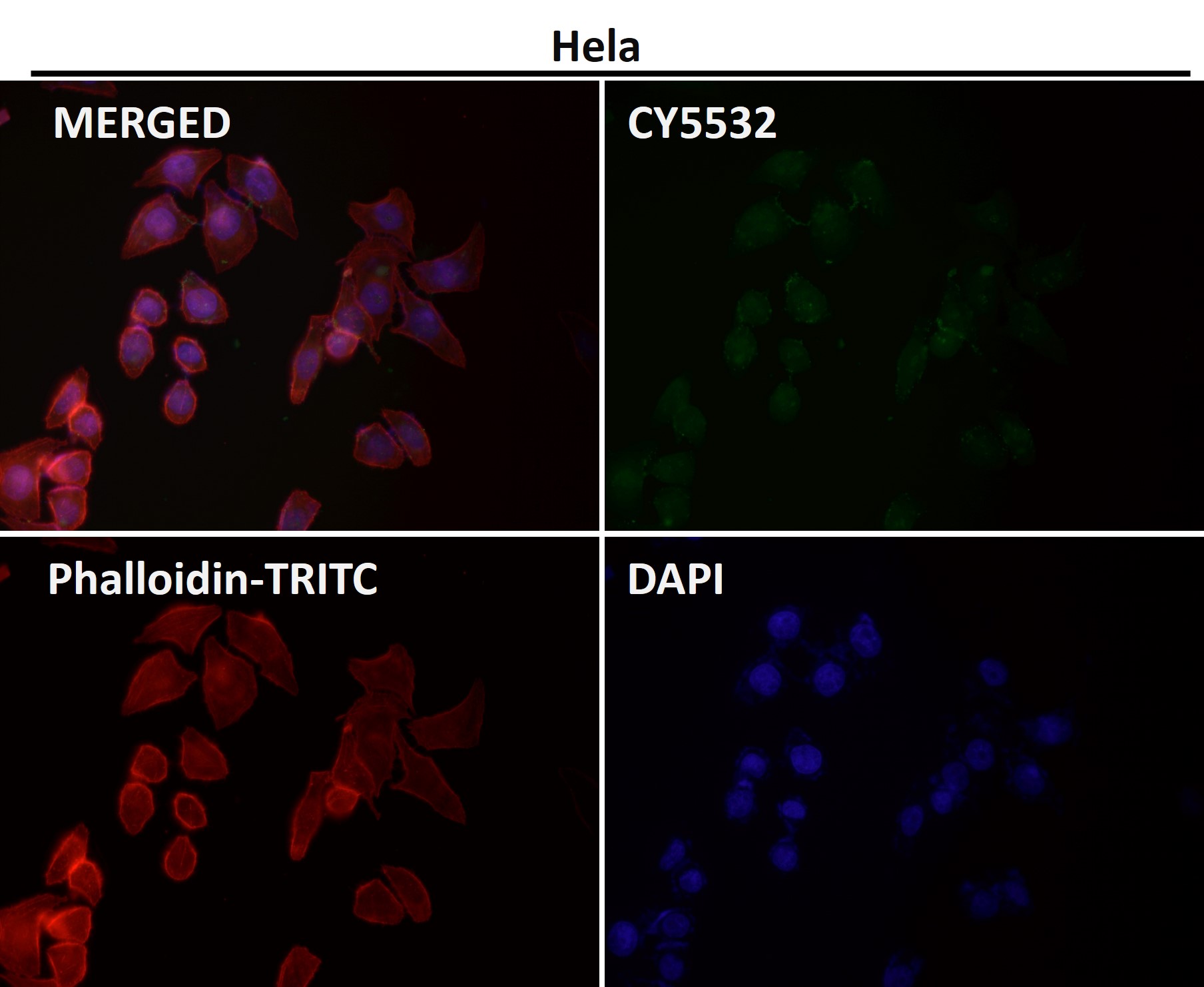 PI3 kinase p85 beta Ab