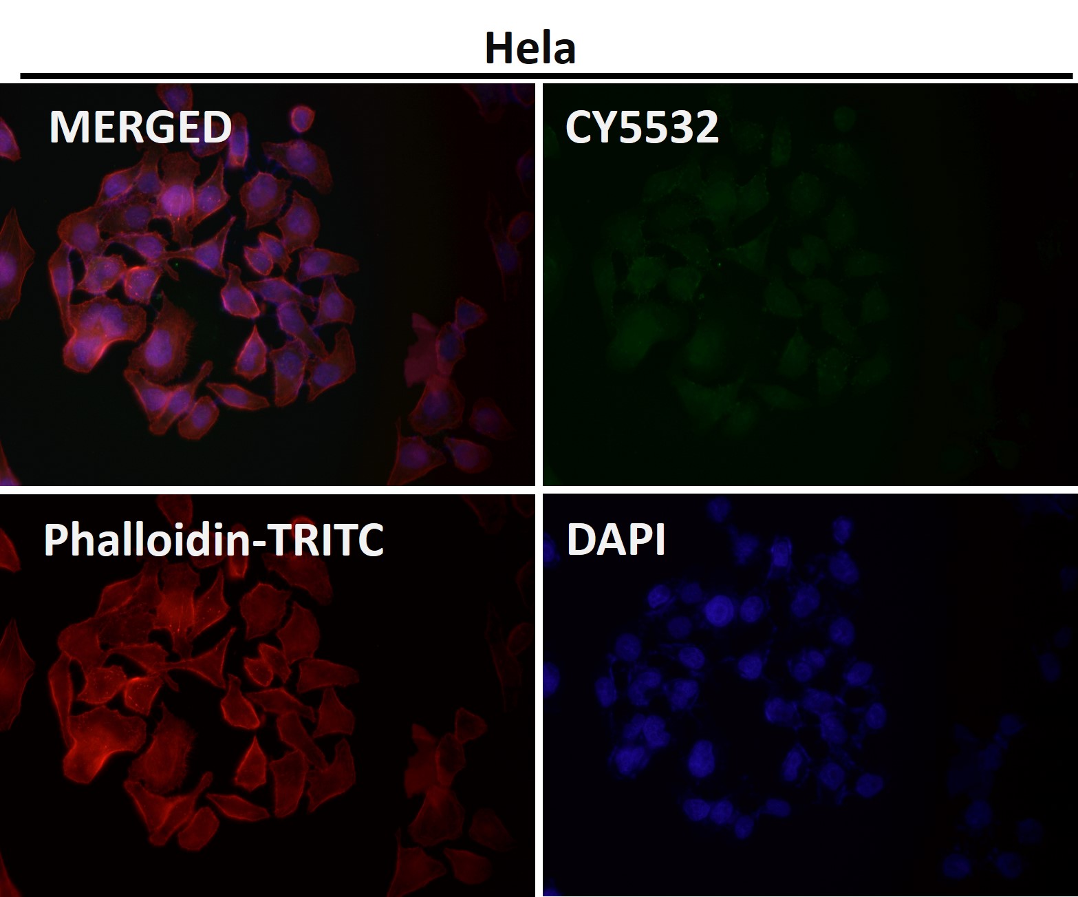 PI3 kinase p85 beta Ab