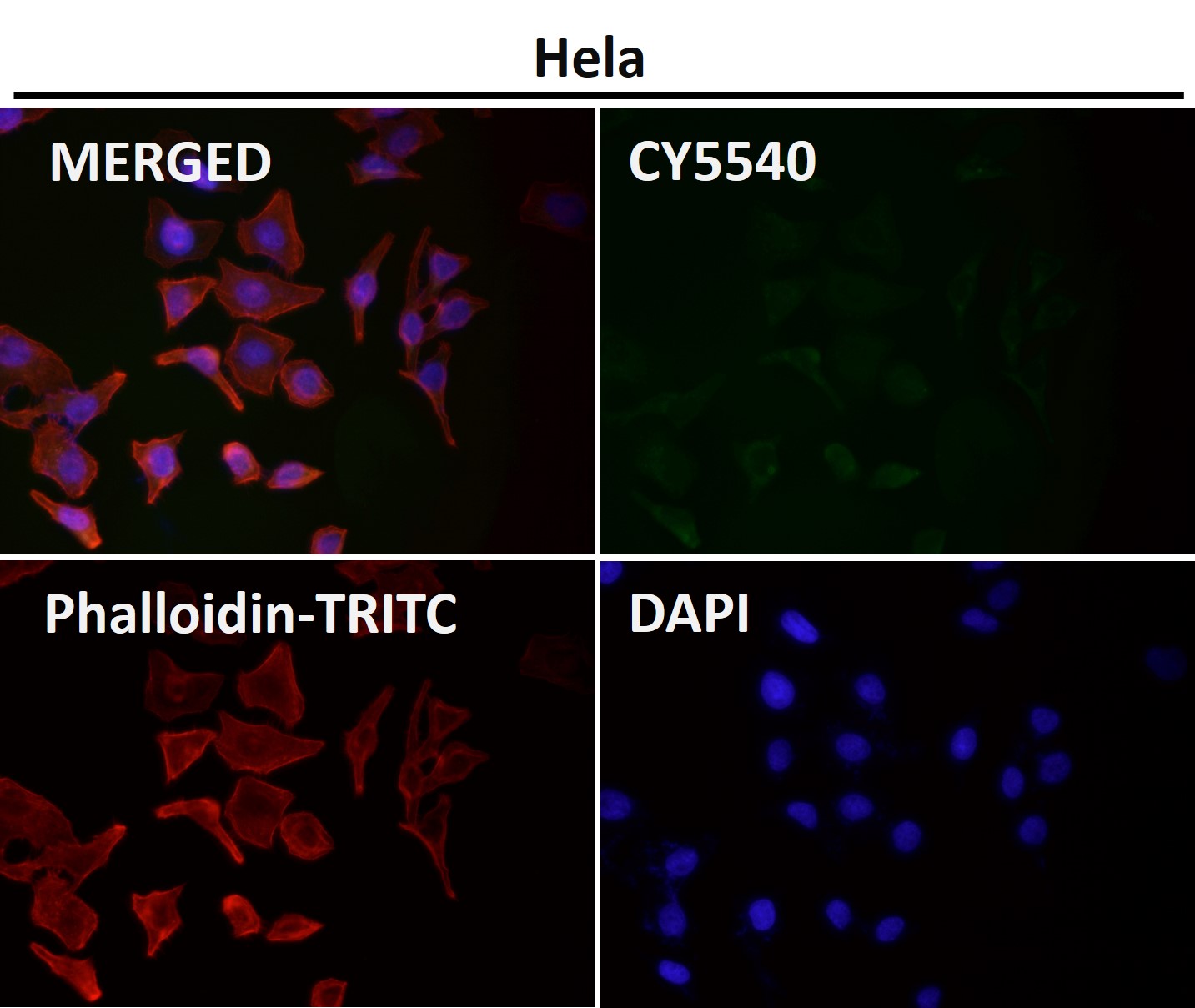 CD8 alpha Ab