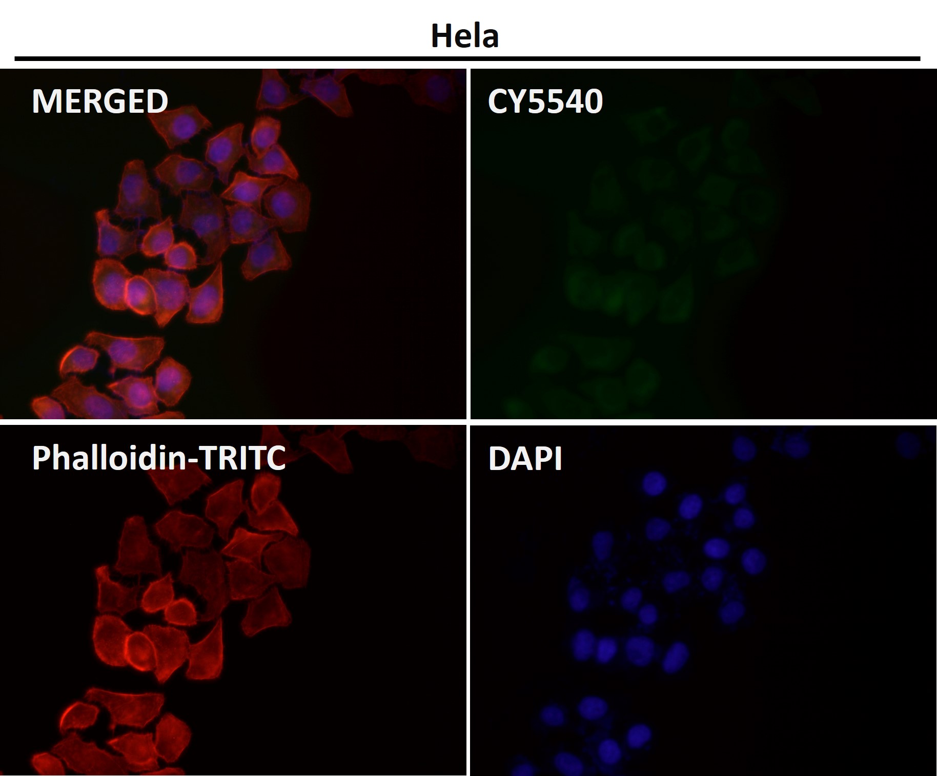 CD8 alpha Ab