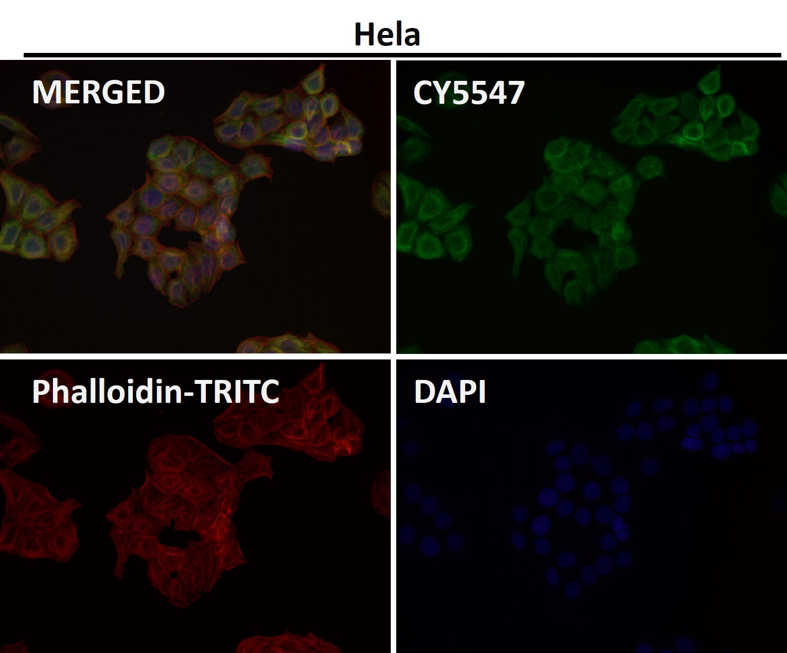 Cytokeratin 7 Ab