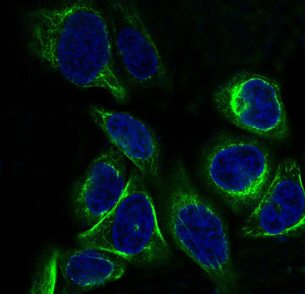 Cytokeratin 7 Ab