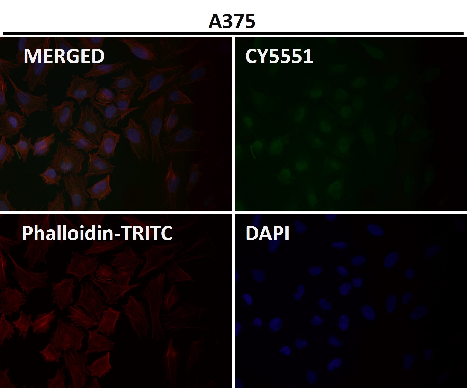 AKT1 Ab