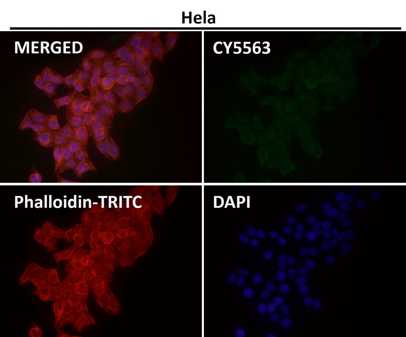 Early endosome antigen 1 Ab