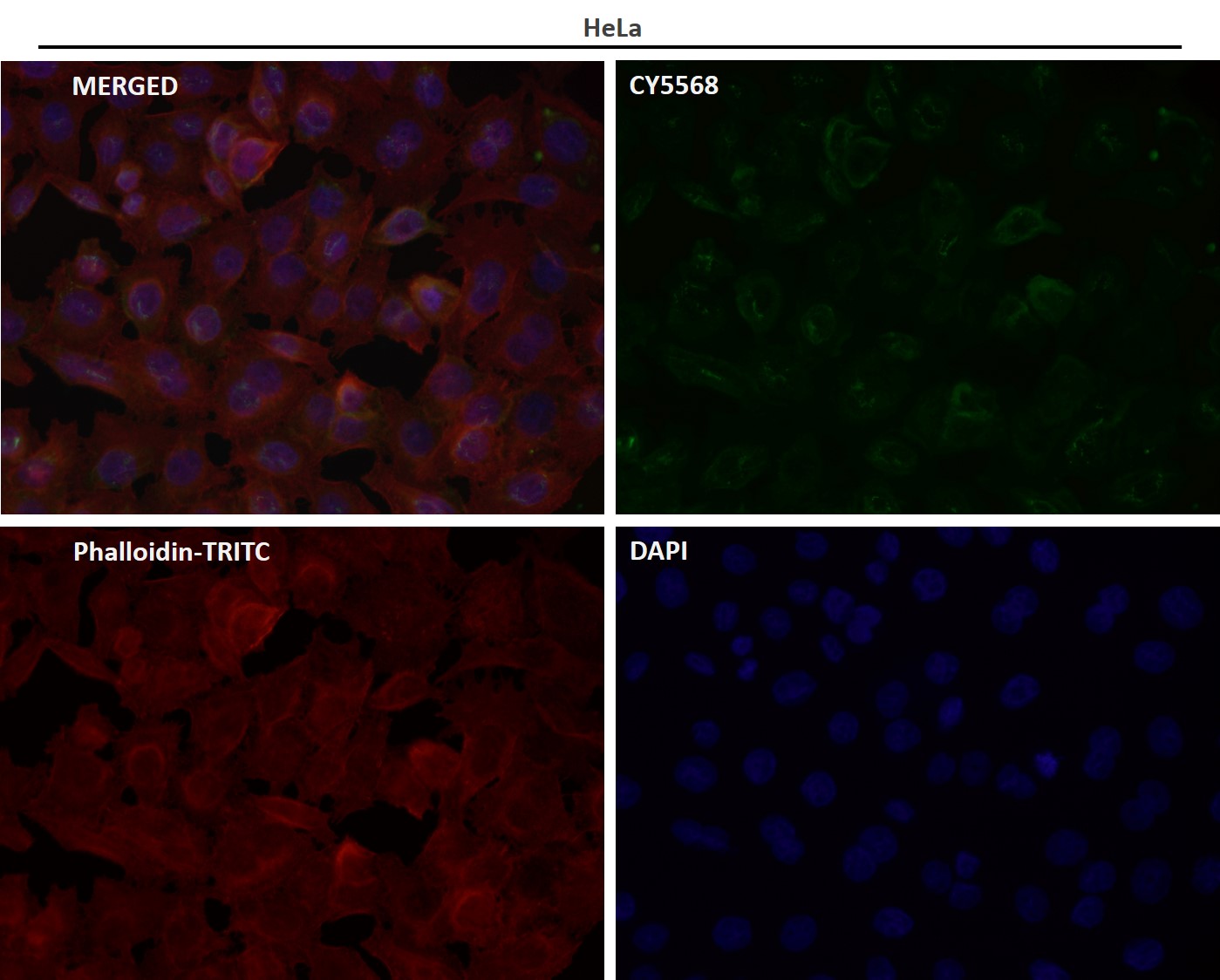 Cytokeratin 16 Ab