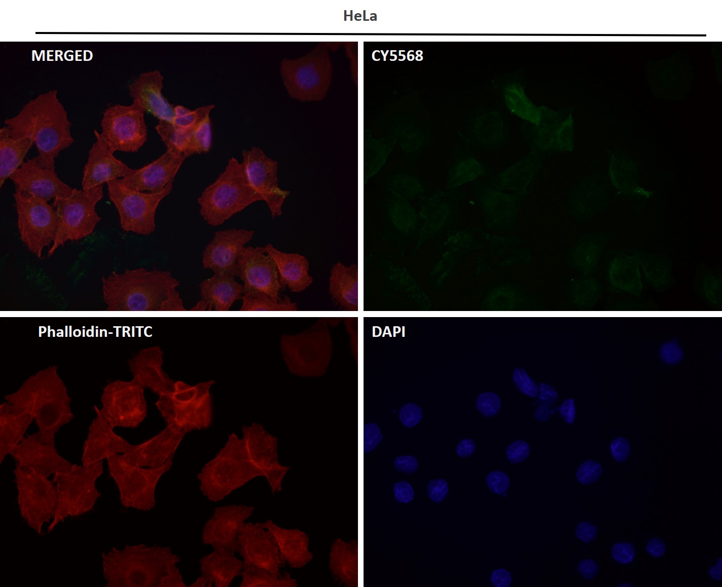 Cytokeratin 16 Ab