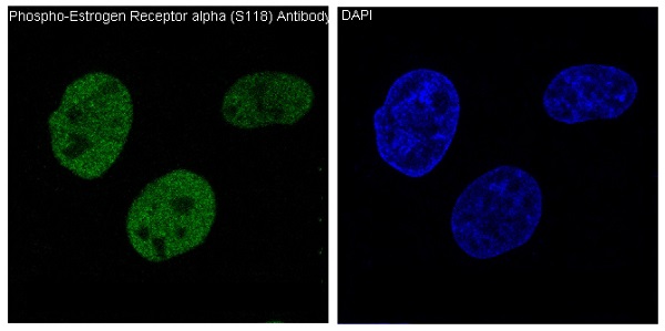 p-Estrogen receptor (S118) Ab