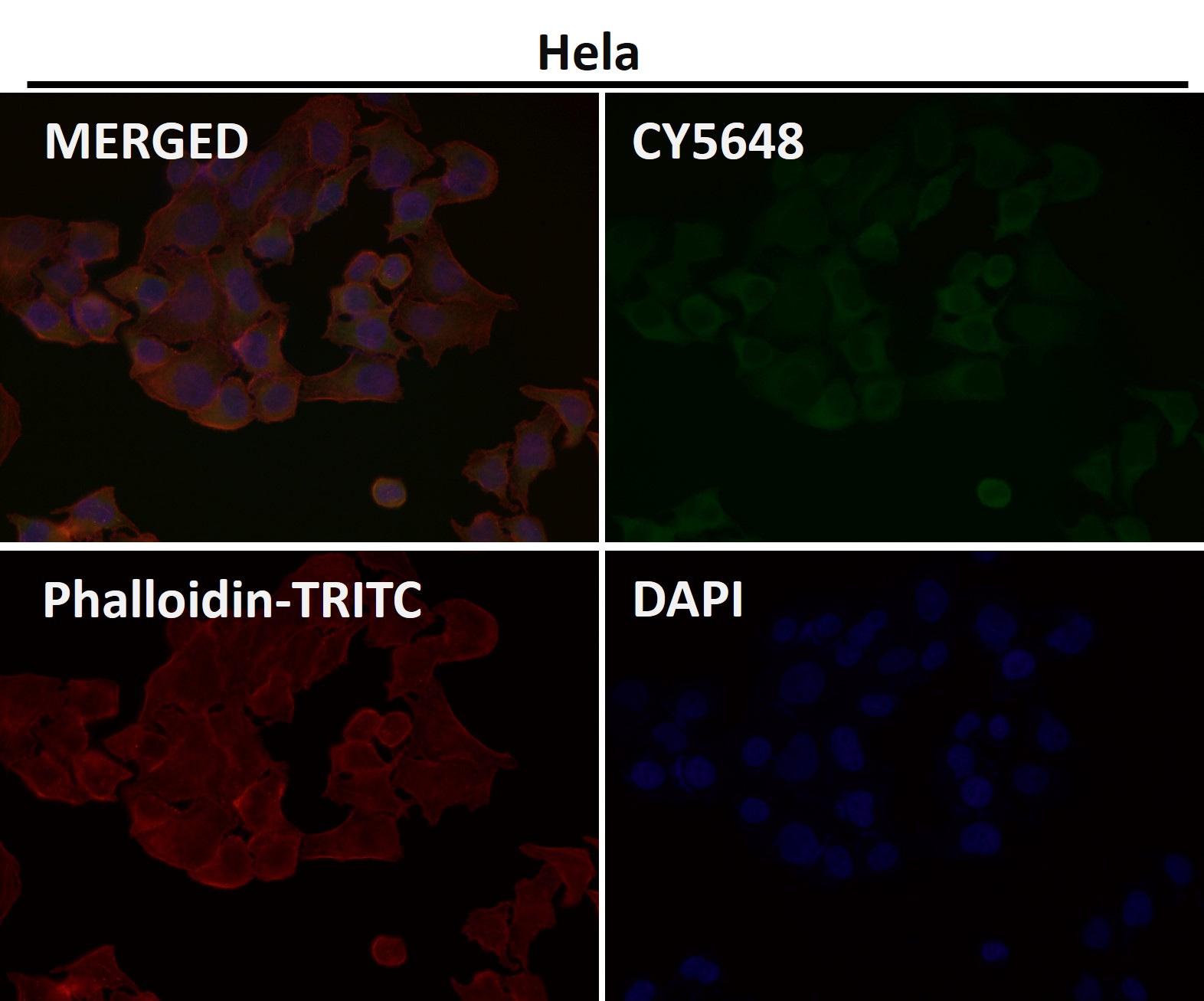 Ferritin Ab