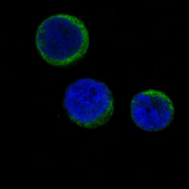 Ferritin Ab