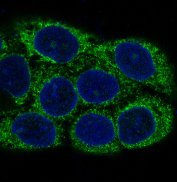 gamma Enolase Ab