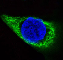 Cytokeratin 14 Ab