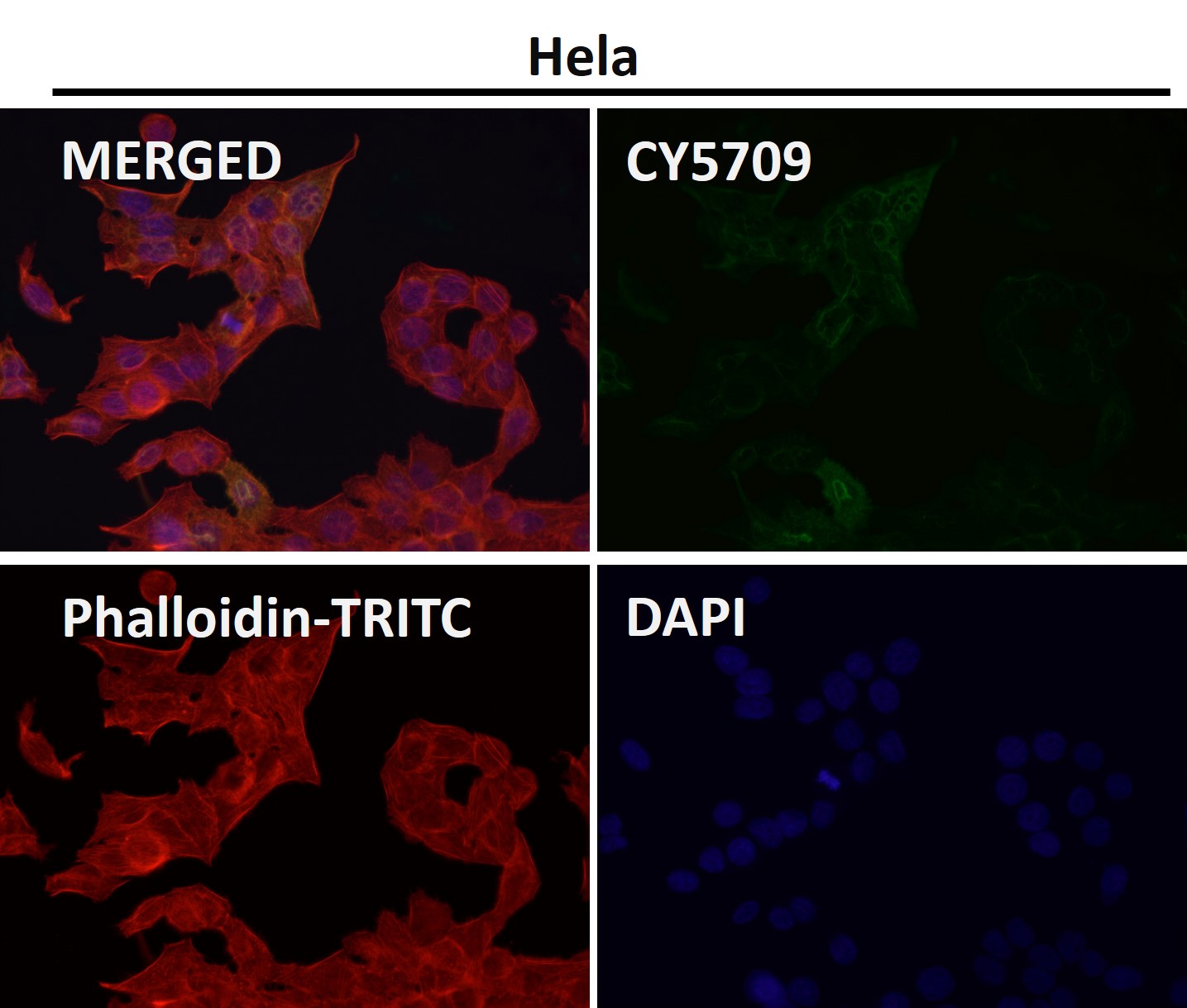 Mucin 1 Ab