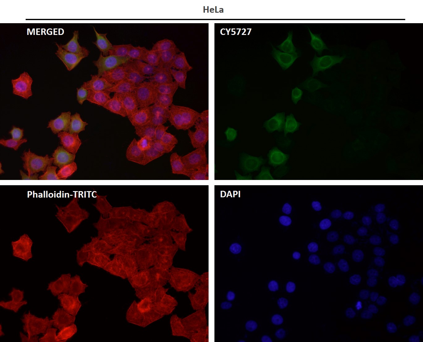 Adiponectin receptor protein 1 Ab