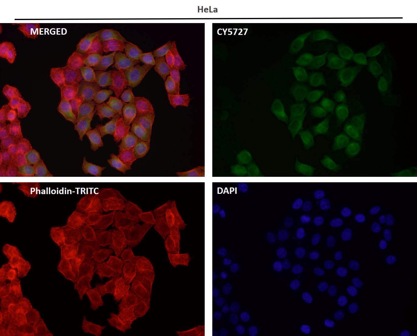 Adiponectin receptor protein 1 Ab