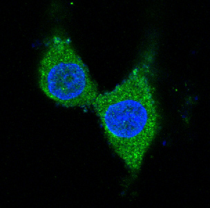 Tyrosine hydroxylase Ab