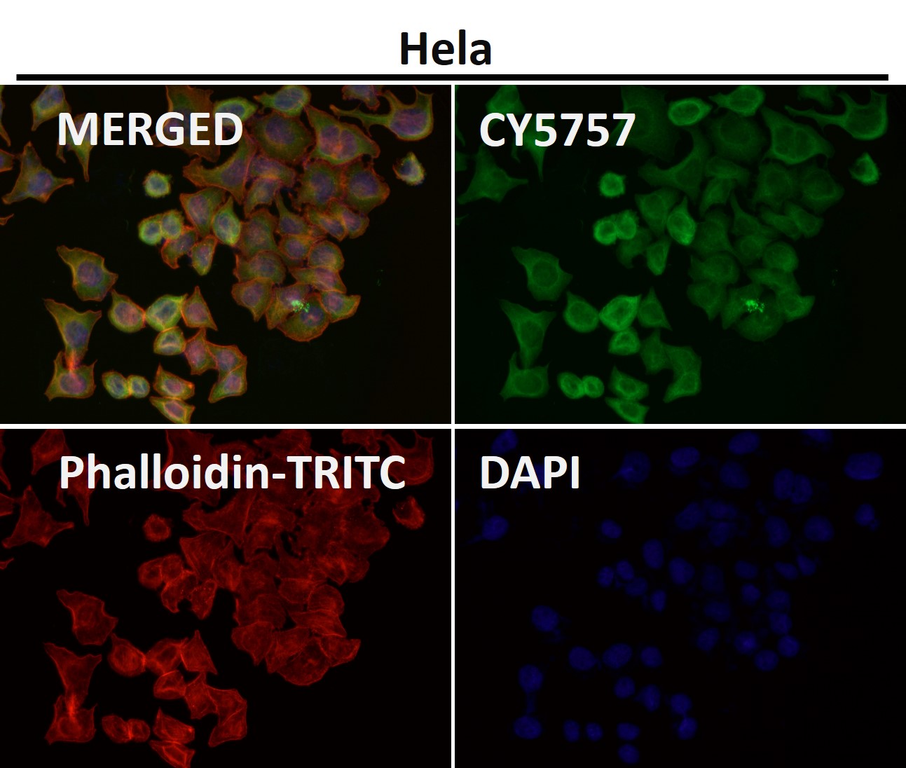 Cytokeratin 18 Ab