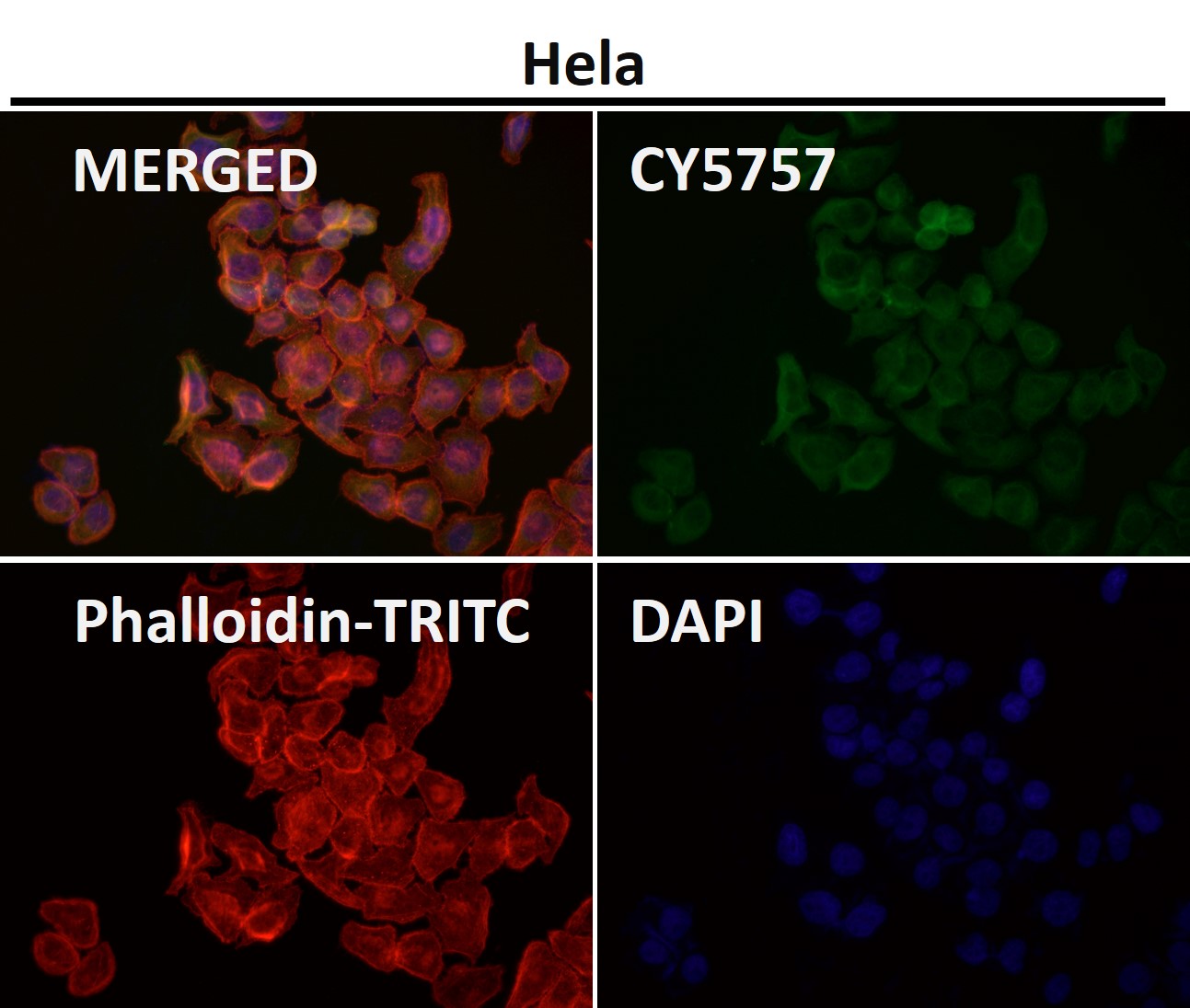 Cytokeratin 18 Ab