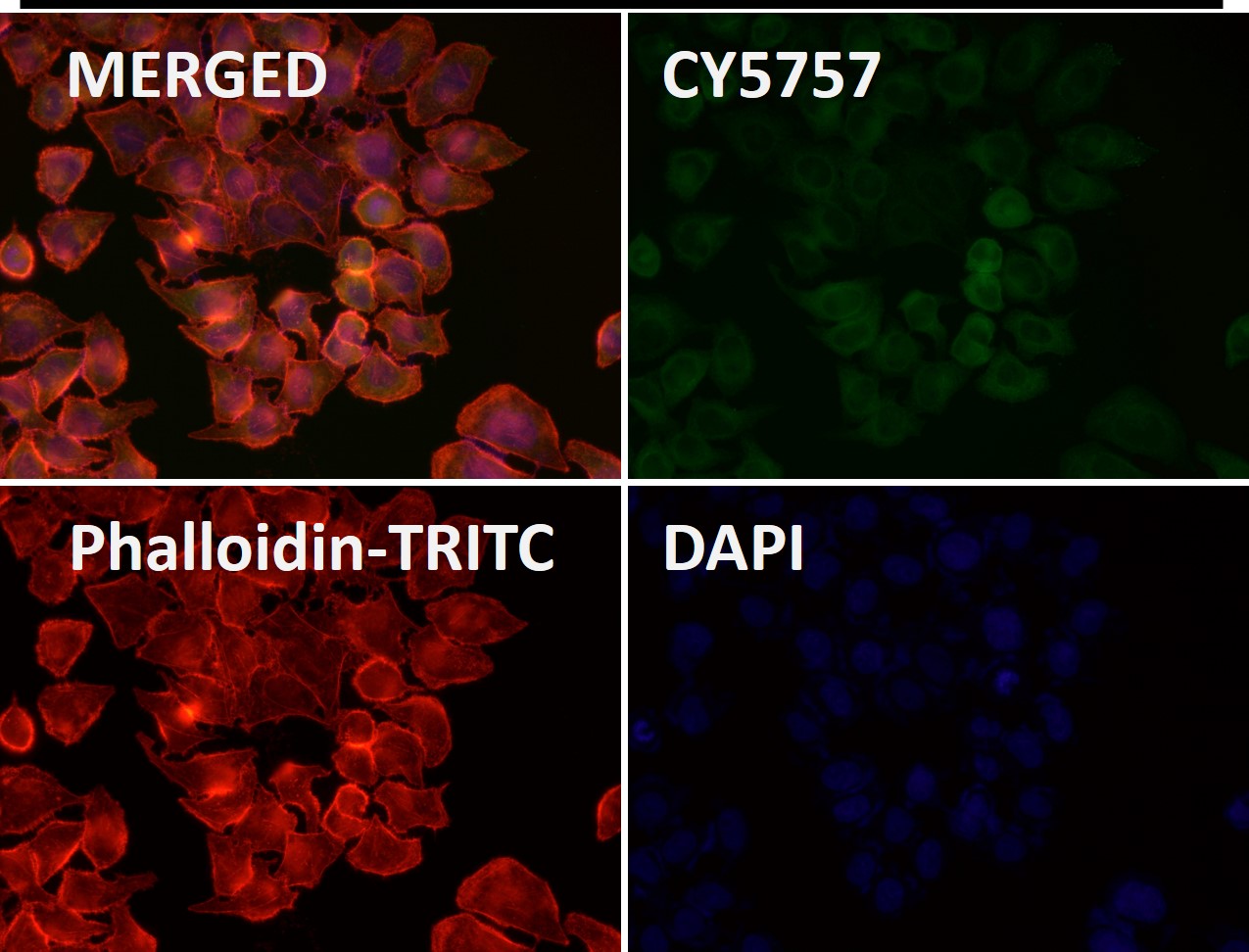 Cytokeratin 18 Ab