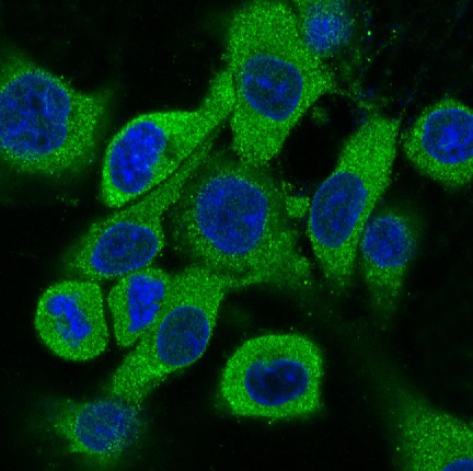 Cytokeratin 18 Ab