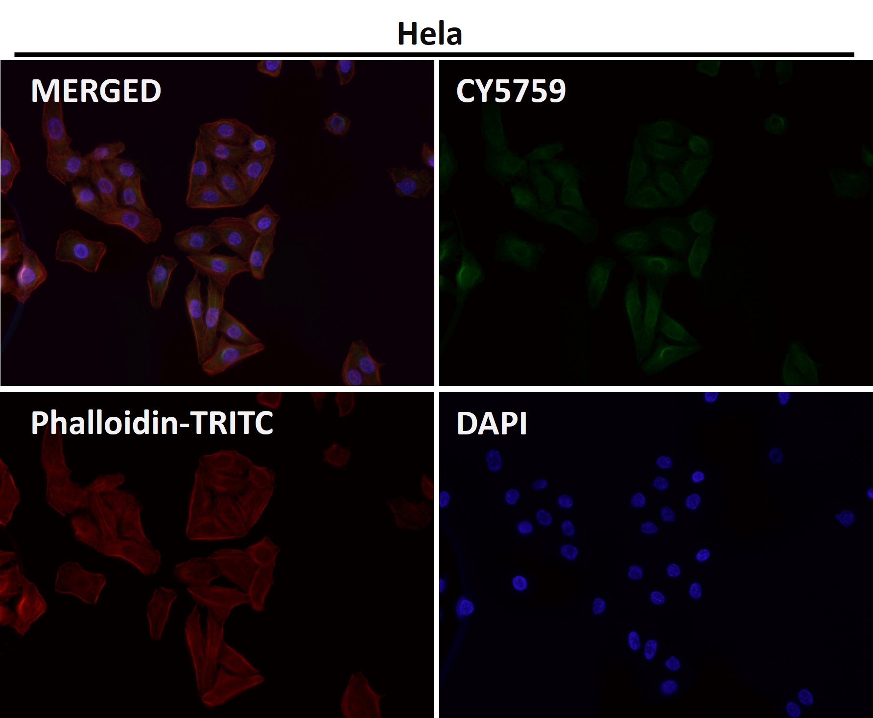 Cytokeratin 1 Ab