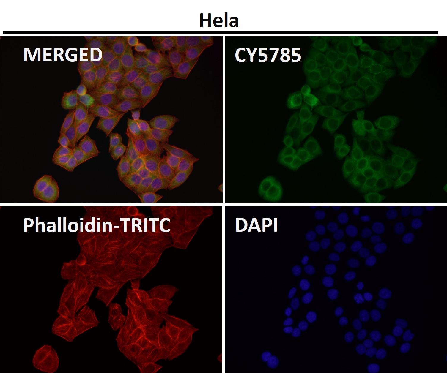 Cytokeratin 7 Ab