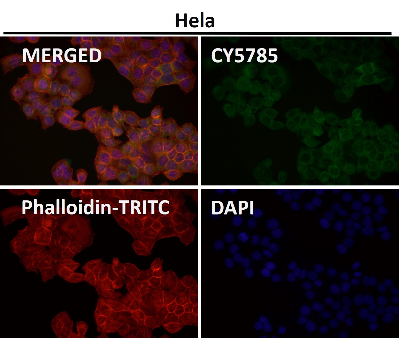 Cytokeratin 7 Ab