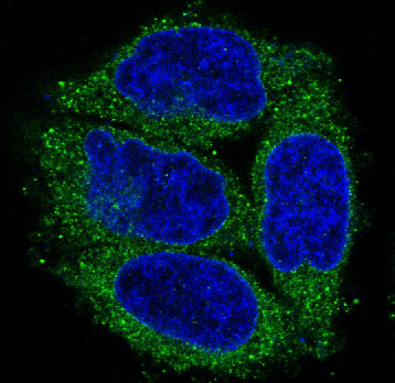 Cytokeratin 7 Ab