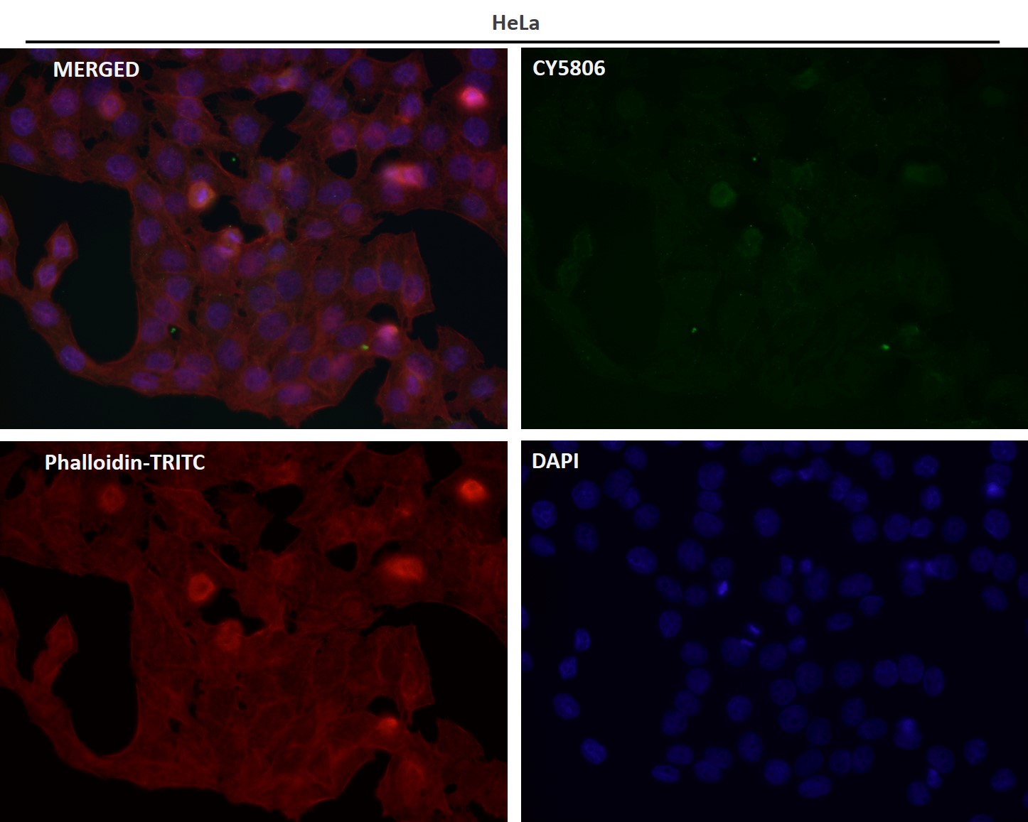 Interferon regulatory factor 5 Ab