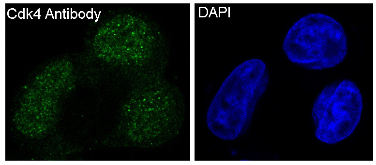 CDK4 Ab