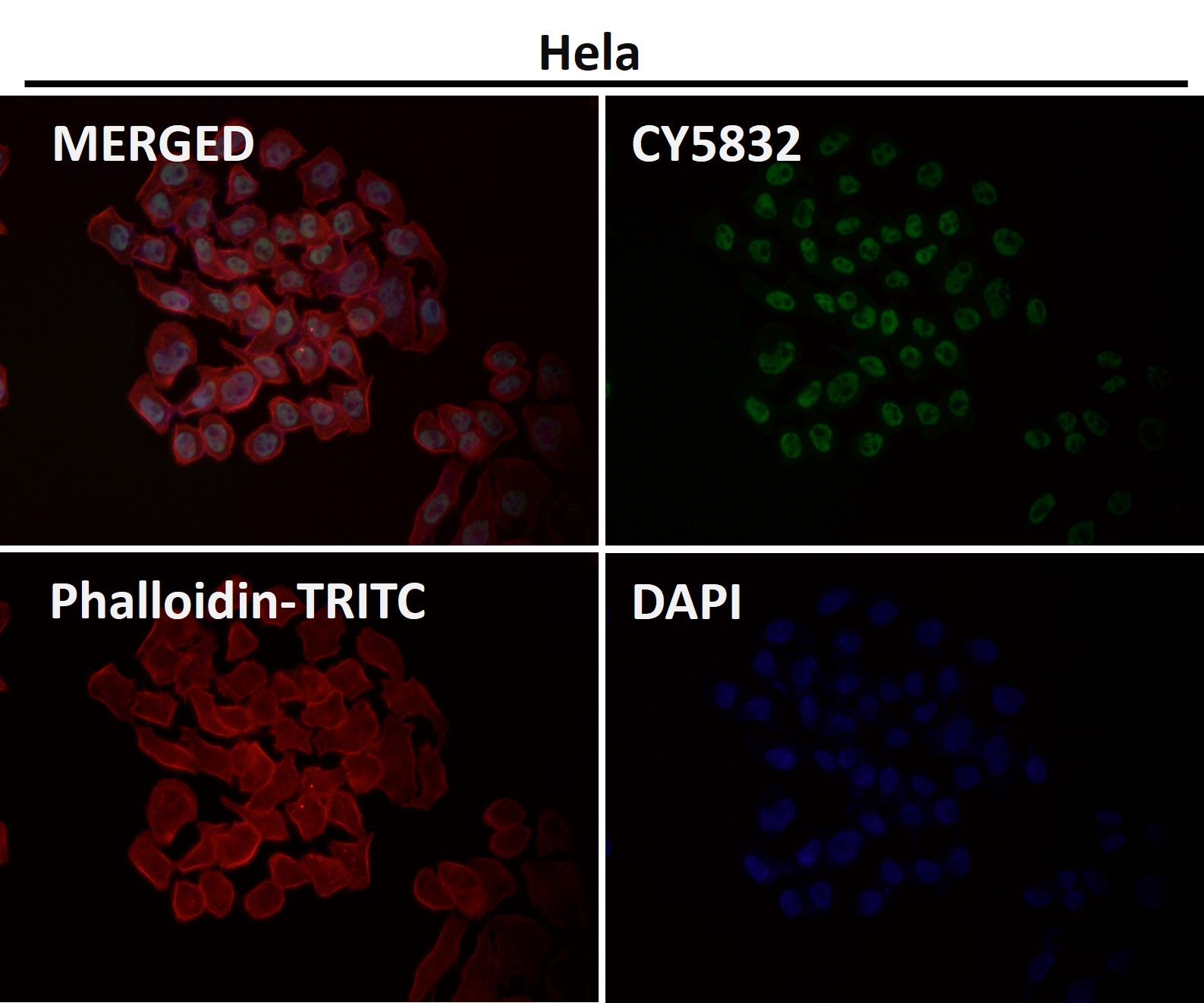 CDK9 Ab