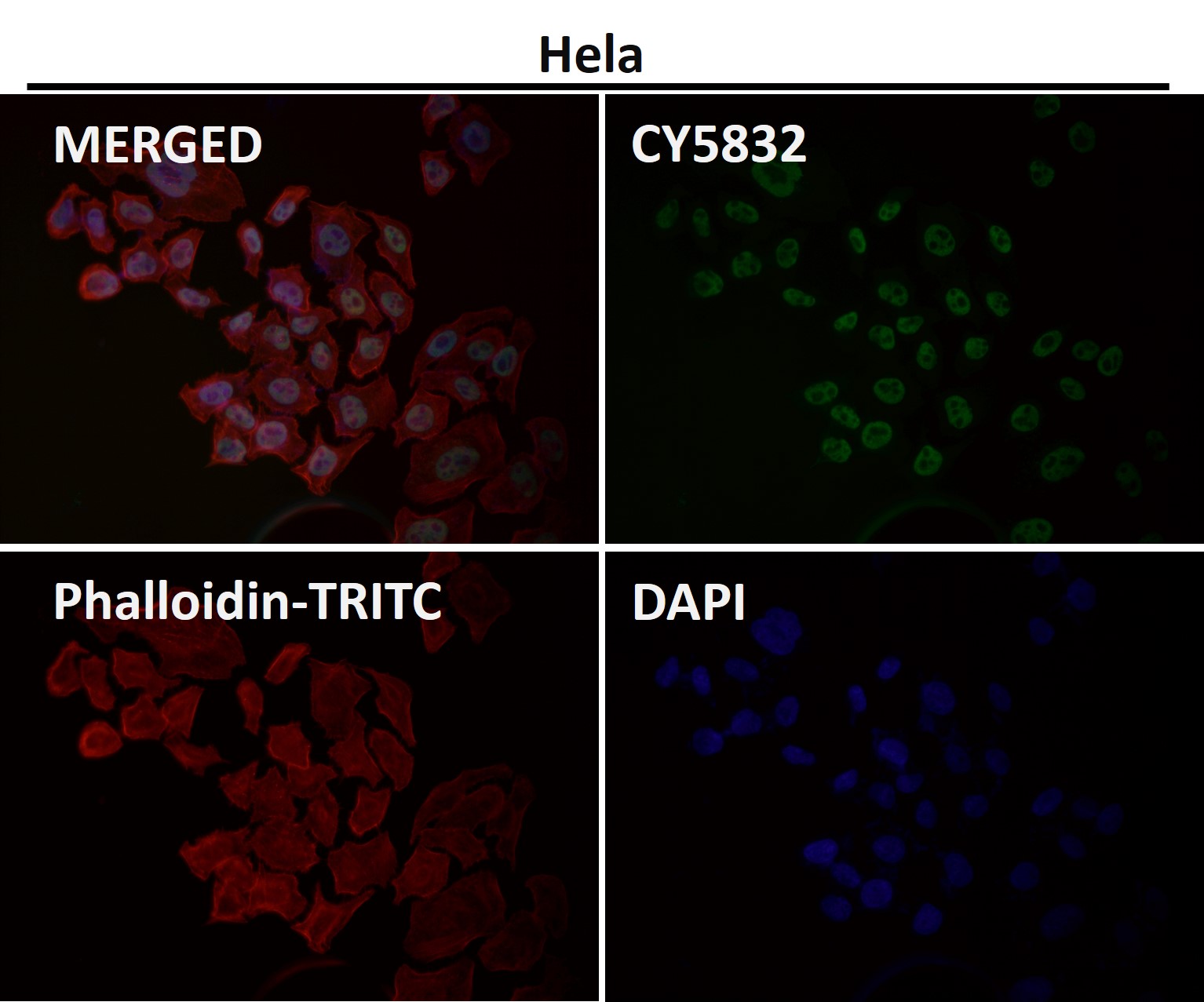 CDK9 Ab