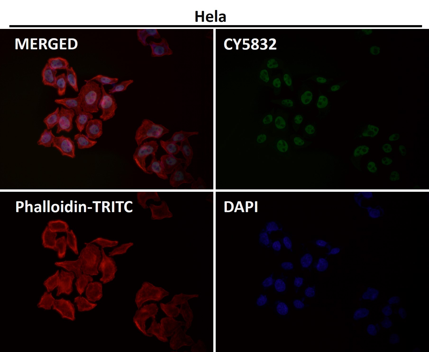 CDK9 Ab