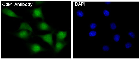 CDK4 Ab