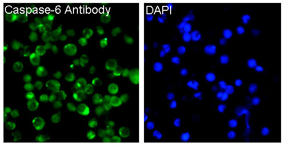 Caspase 6 Ab