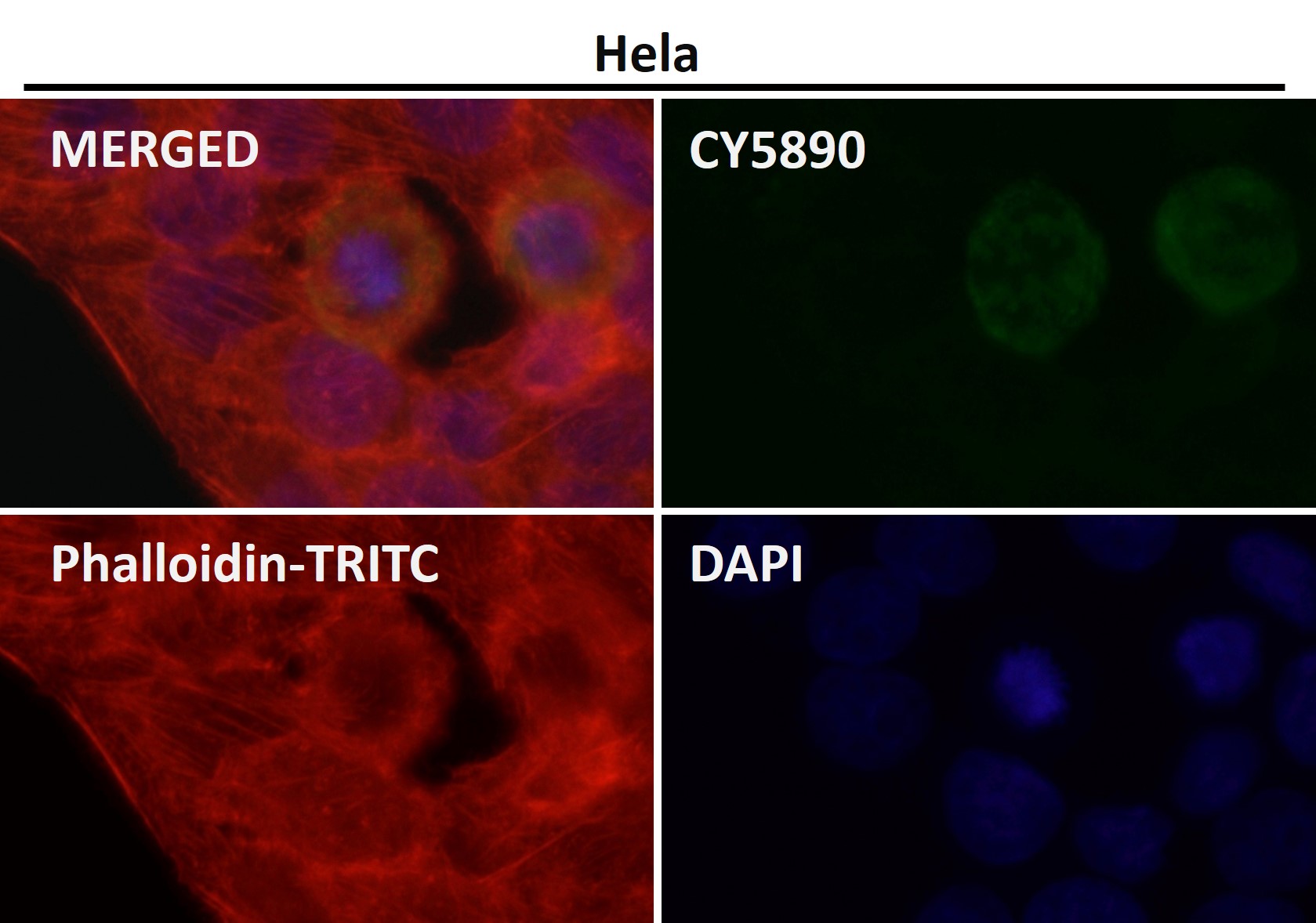 HDAC9 Ab