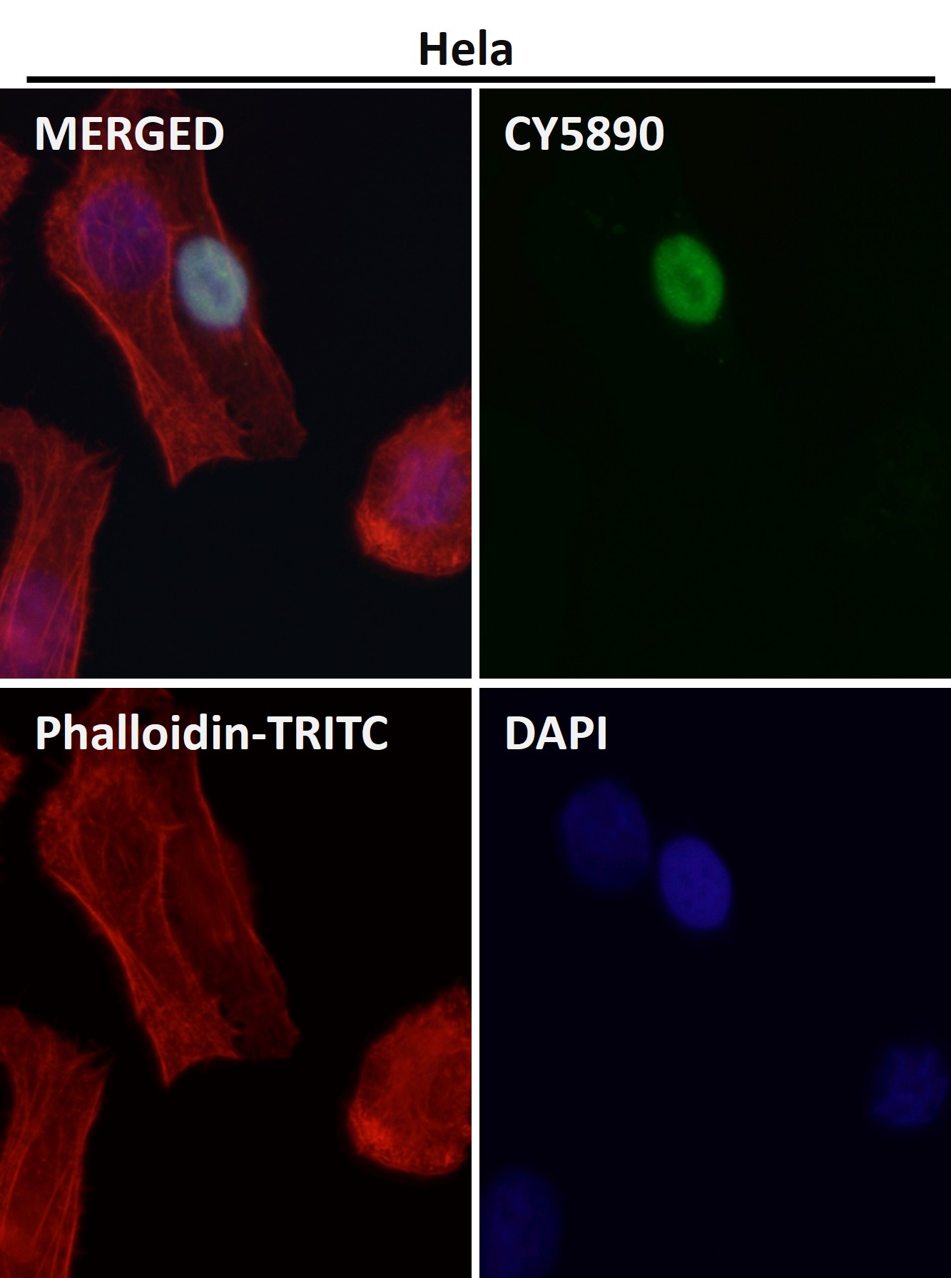 HDAC9 Ab