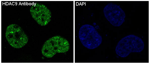 HDAC9 Ab